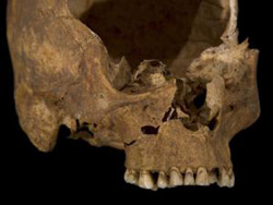 The front of Richard III's skull is seen in this photograph provided by the University of Leicester.